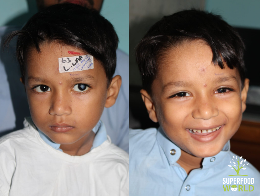 Thanks to Our Customers who have Helped Fund Cataract Eye Operations through our 25% Donation Profit Pledge